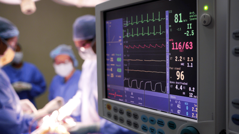 Introducing EKG - Essential Kubernetes Gauges